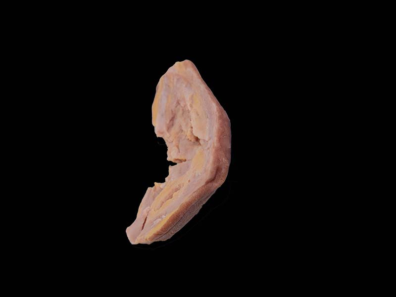 Soft Simulated Hodgkin's Disease Anatomy Model