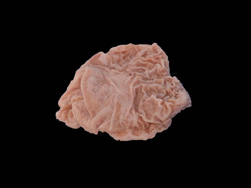 Soft Simulated Silicone Duodenal Ulcer Model