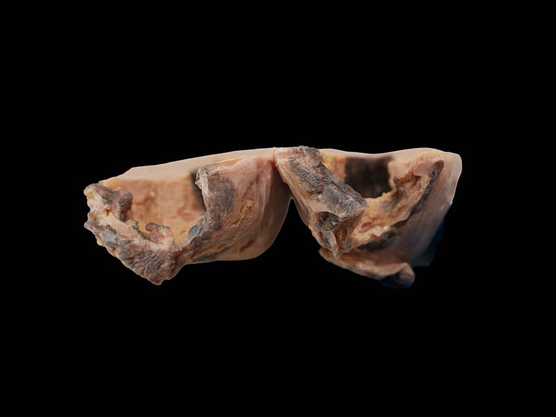 Soft Simulated Uterine Gangrene Model