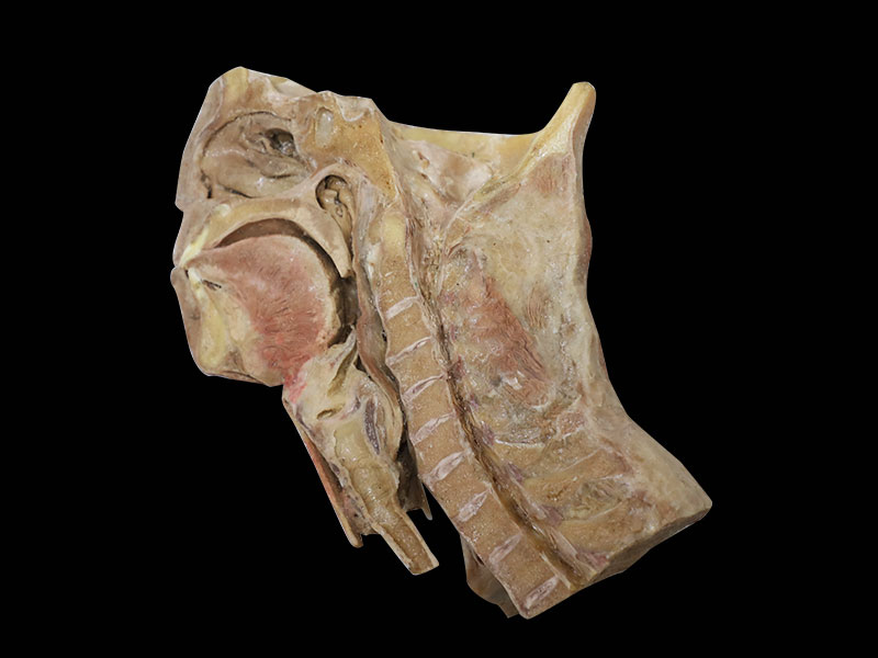 Submandibular Triangle Plastinated Specimen