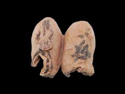 Uterine Gangrene Model